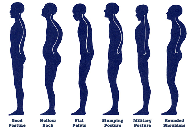 Poor Posture is a leading cause of injury